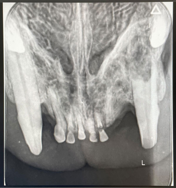 Digitales Dentalröntgen, Bild 2